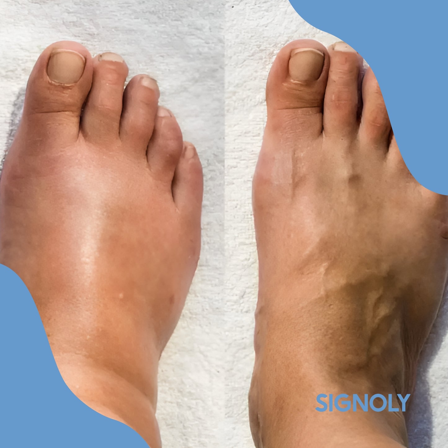 Signoly - Foot Massager