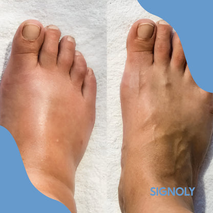 Signoly - Foot Massager